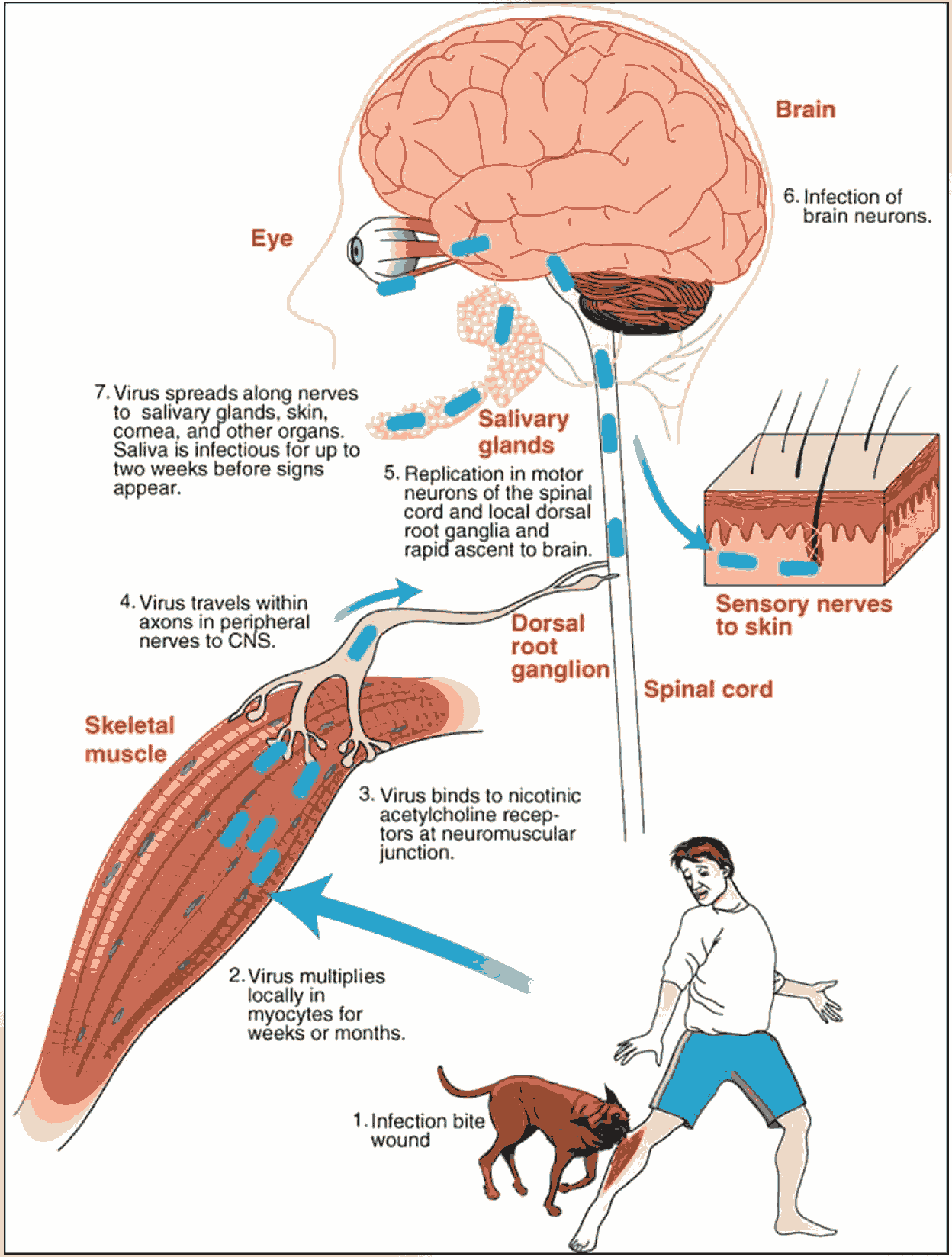 Pathogenesis of rabies virus infection